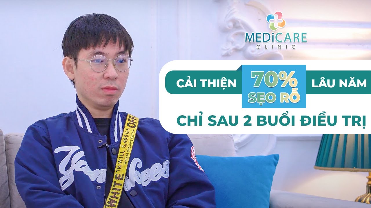 CẢI THIỆN 70% TÌNH TRẠNG SẸO RỖ CHỈ SAU 2 BUỔI ĐIỀU TRỊ | MEDICARE CLINIC