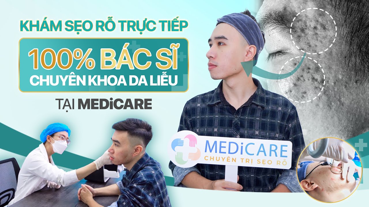 HÀNH TRÌNH ĐIỀU TRỊ SẸO RỖ -  PHÒNG KHÁM DA LIỄU MEDICARE