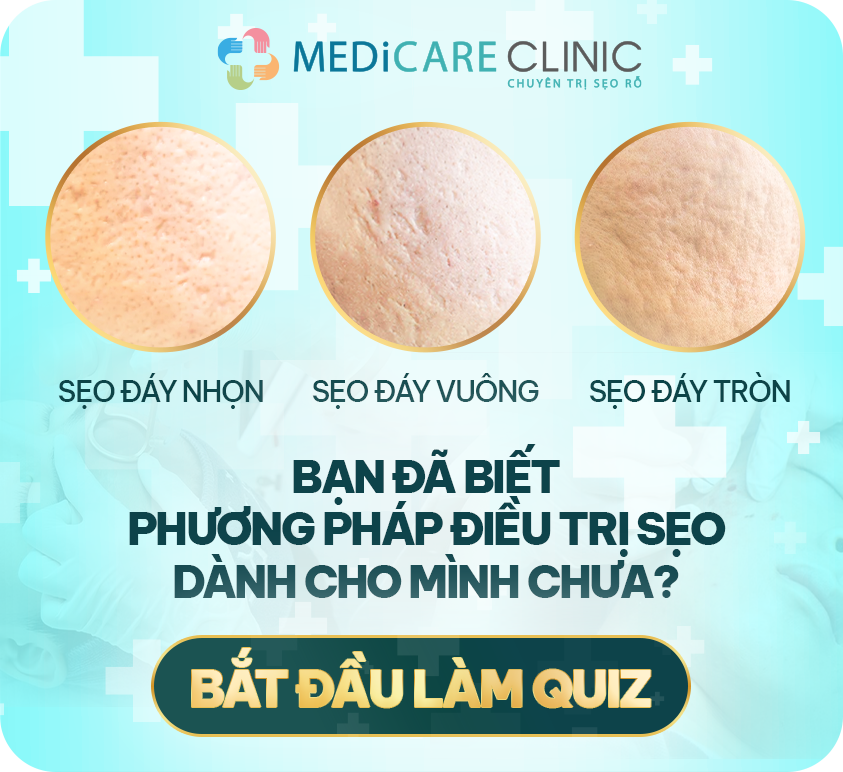 Link Quiz Sẹo