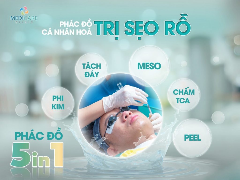 Phác đồ Cá Nhân Hoá Trị Sẹo Rỗ