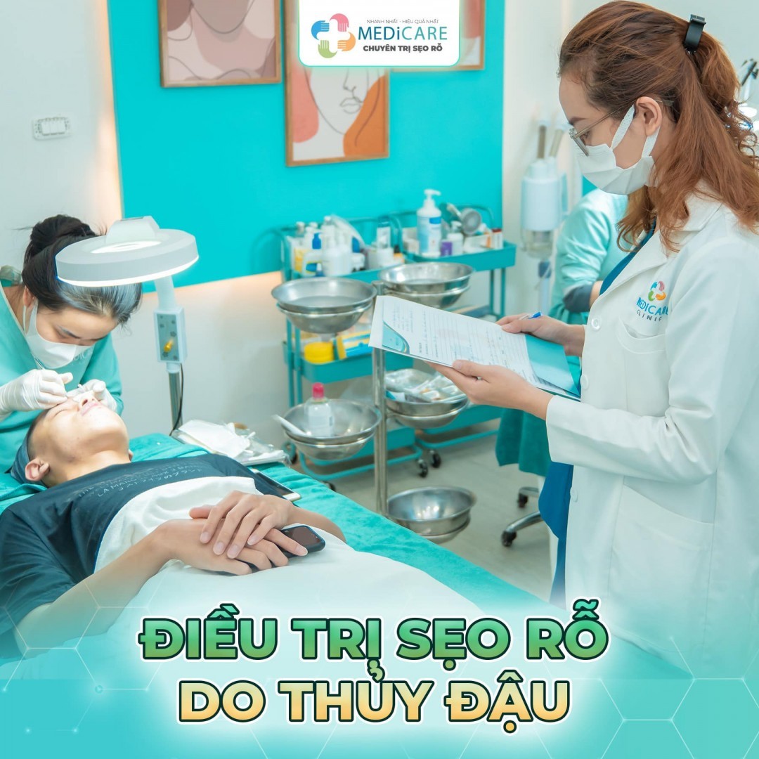 điều Trị Sẹo Rỗ Do Thuỷ đậu