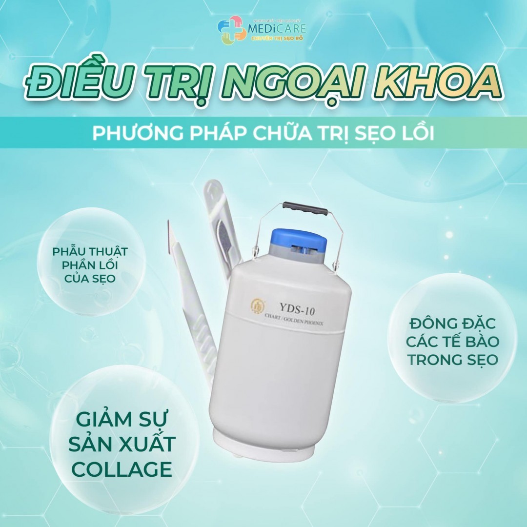 điều Trị Ngoại Khóa