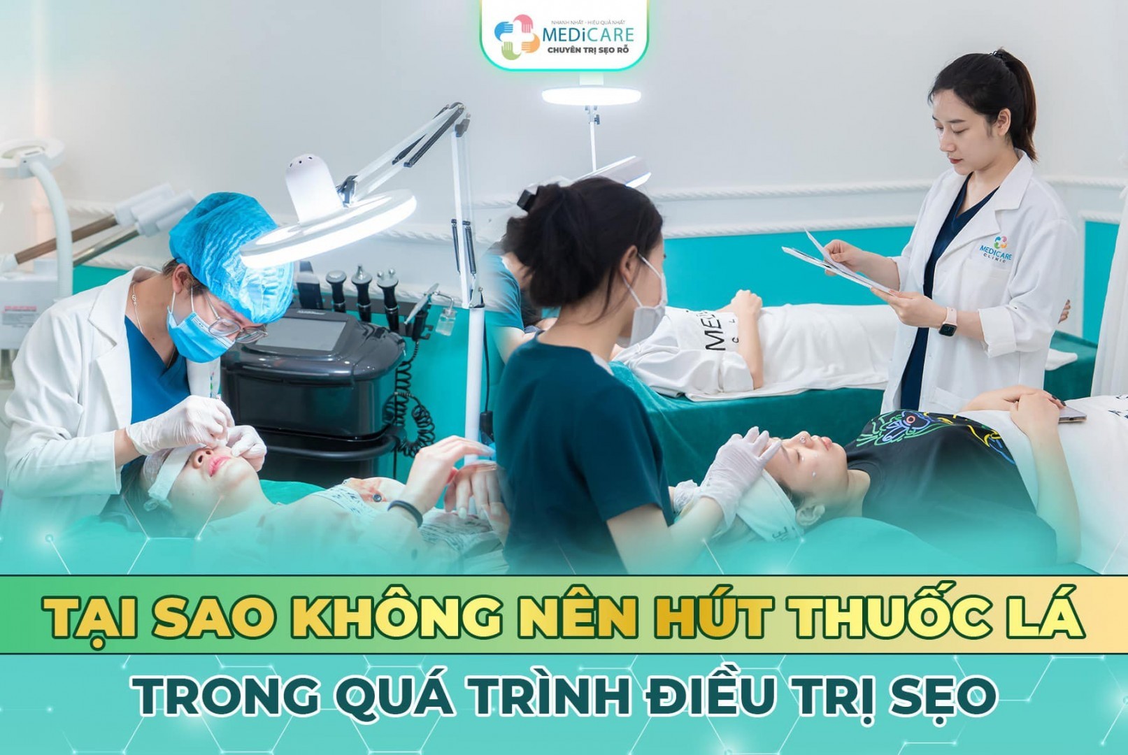 Ko Nên Dùng Thuốc Lá