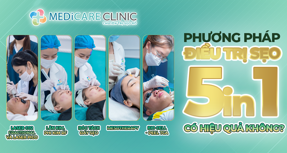 PhƯƠng PhÁp TrỊ SẸo ĐỘc QuyỀn 5in1 CÓ HiỆu QuẢ KhÔng