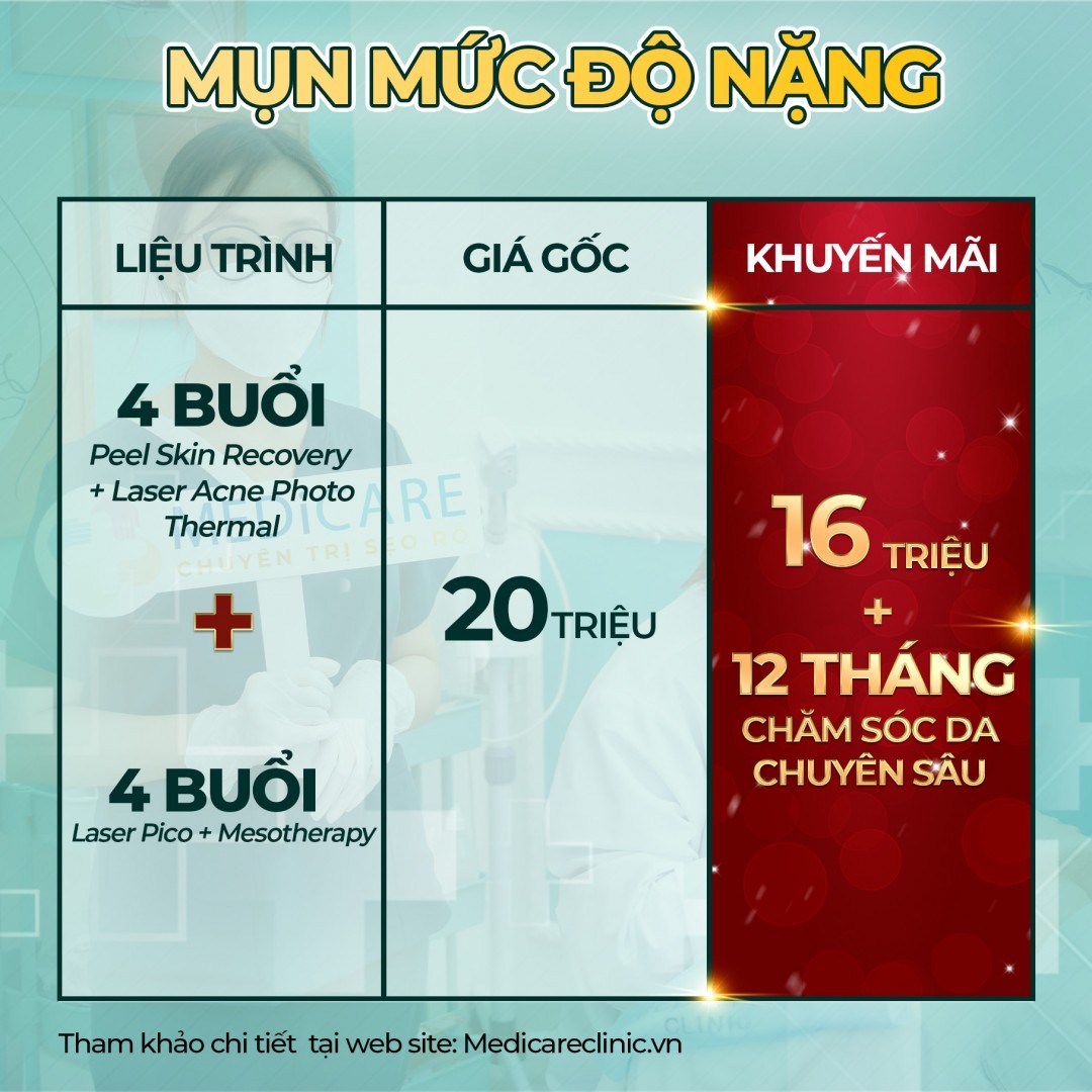 Bảng Giá Trị Mụn Tháng 8:2023 4