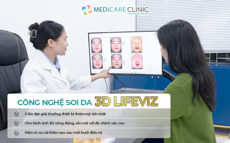 công nghệ soi da 3D LifeViz trong điều trị sẹo tại Medicare clinic