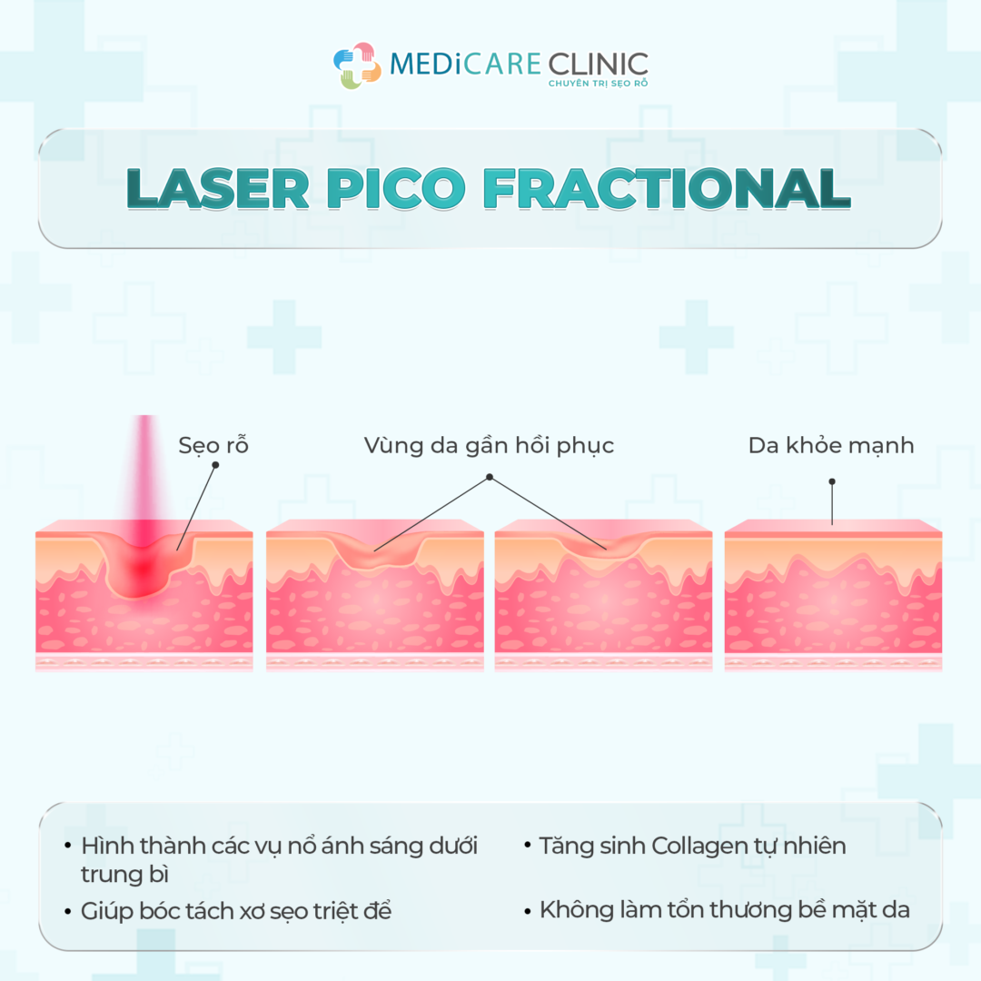 chế độ laser pico fractional điều trị da sẹo, trẻ hoá, căng bóng.,...