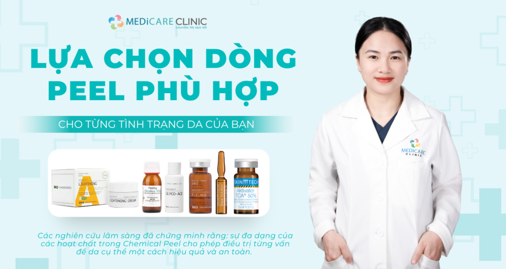 Lựa chọn dòng Peel phù hợp