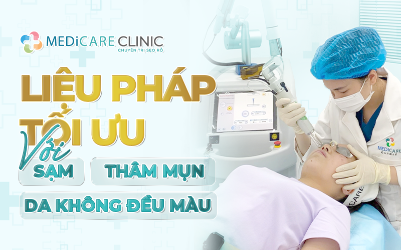 sạm thâm mụn không đều màu và giải pháp