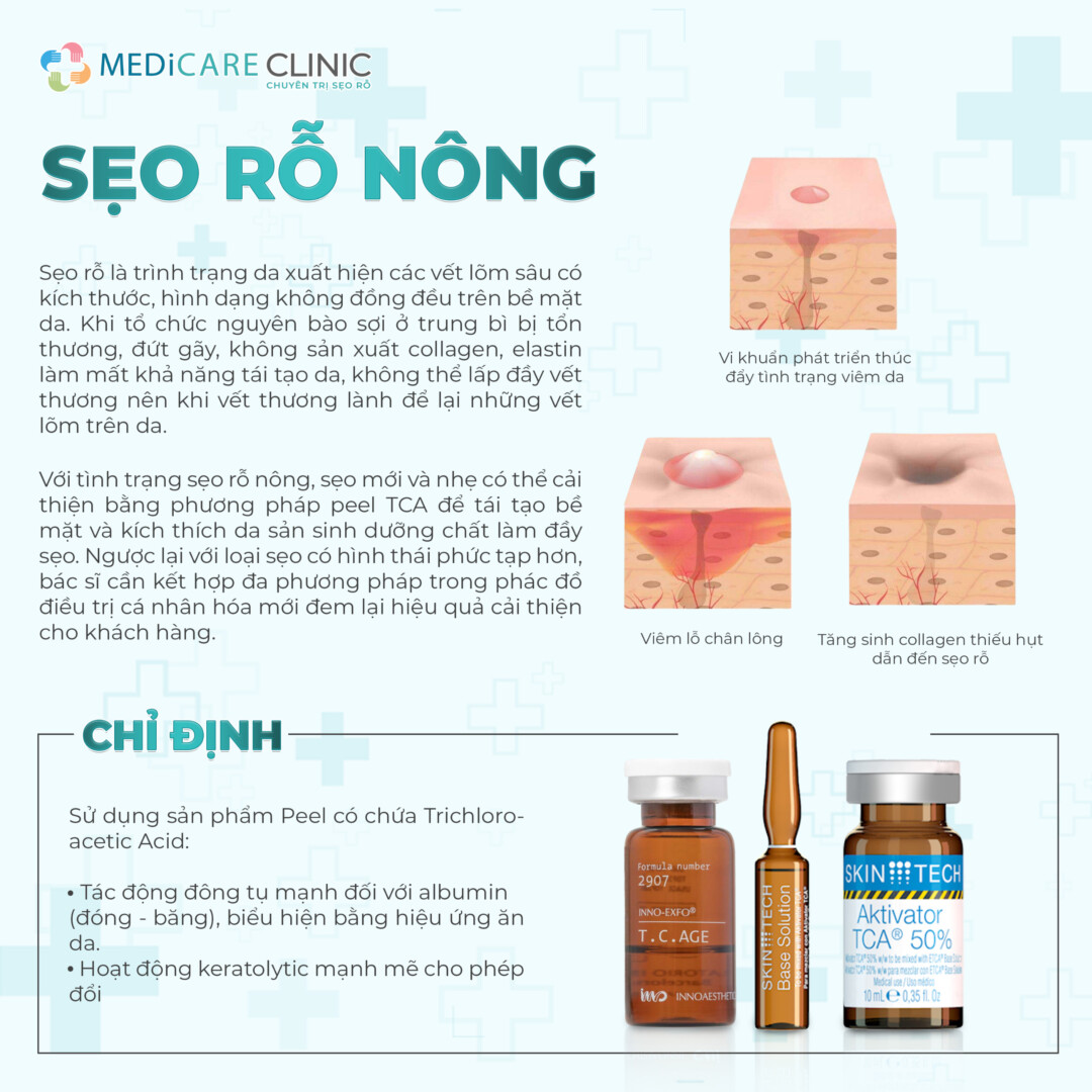 Dòng Peel phù hợp cho sẹo rỗ nông