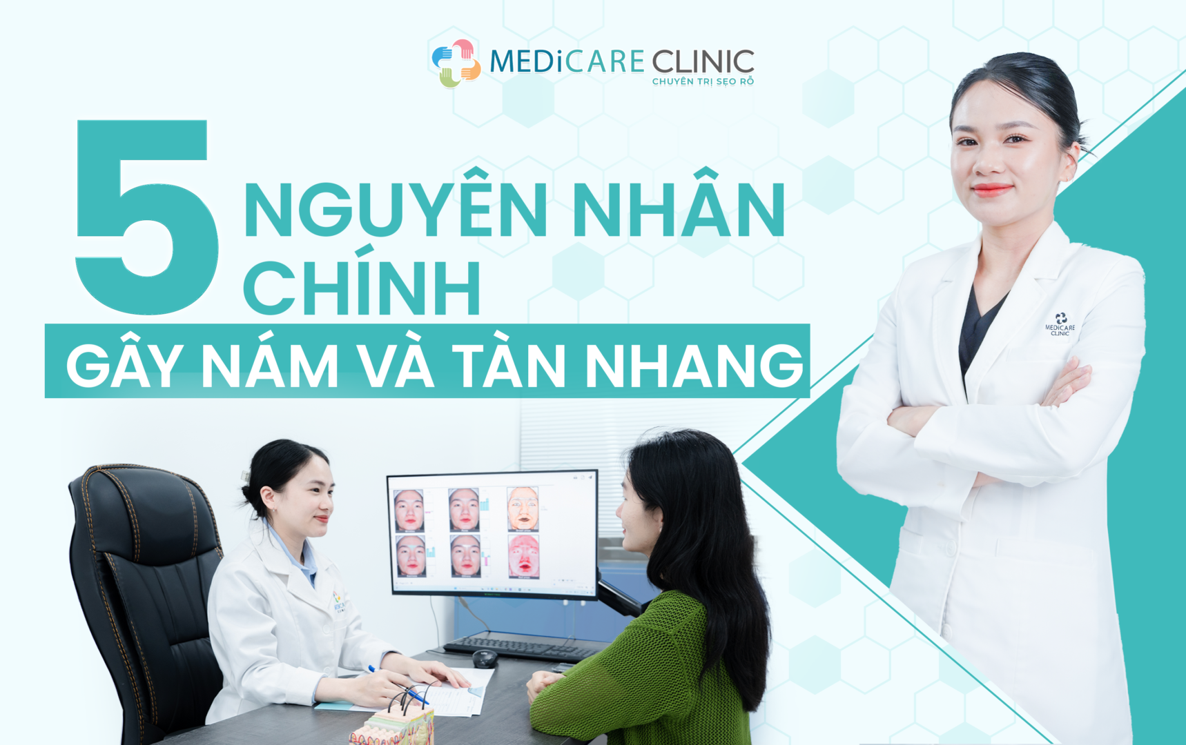 5 Nguyên Nhân Chính Gây Nám Và Tàn Nhang