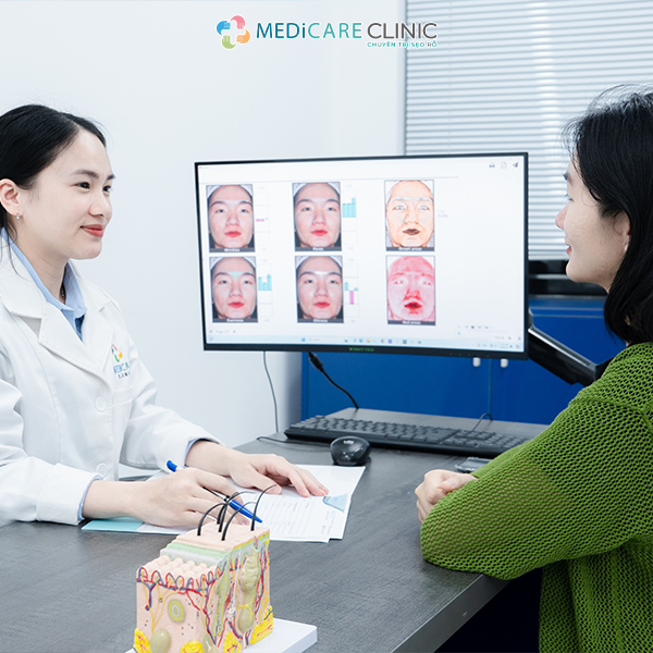 ngăn ngừa nguyên nhân chính gây nám và tàn nhang qua việc thăm khám tại Medicare clinic