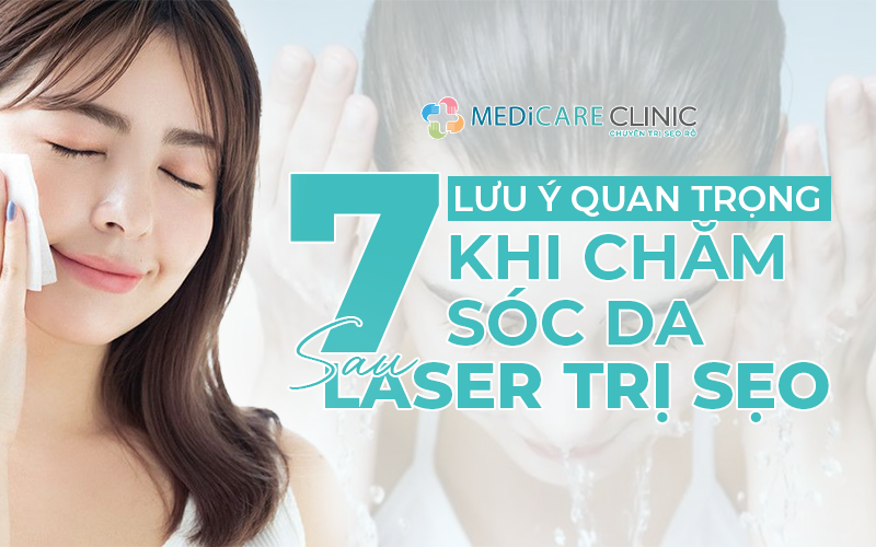 7 Lưu Ý Quan Trọng Khi Chăm Sóc Da Sau Laser Trị Sẹo