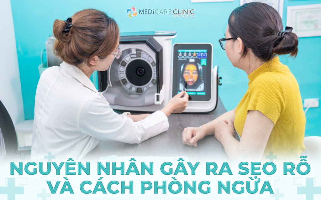 Nguyên Nhân Gây Ra Sẹo Rỗ Và Cách Hạn Chế