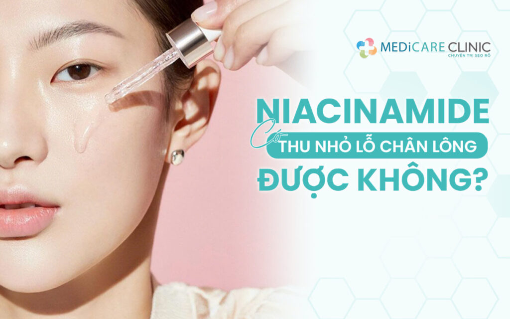 Niacinamide Có Thu Nhỏ Lỗ Chân Lông Được Không?