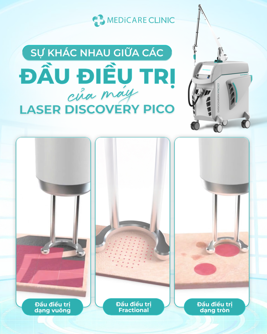 Các đầu điều trị của Laser Discovery Pico