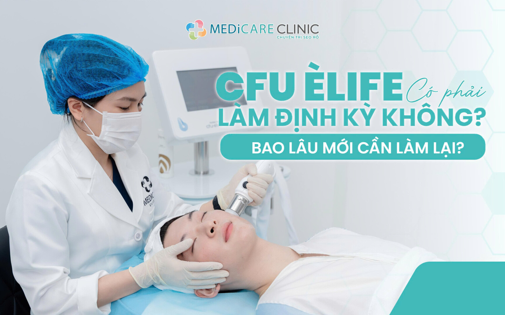 CFU Èlife có phải làm định kỳ không