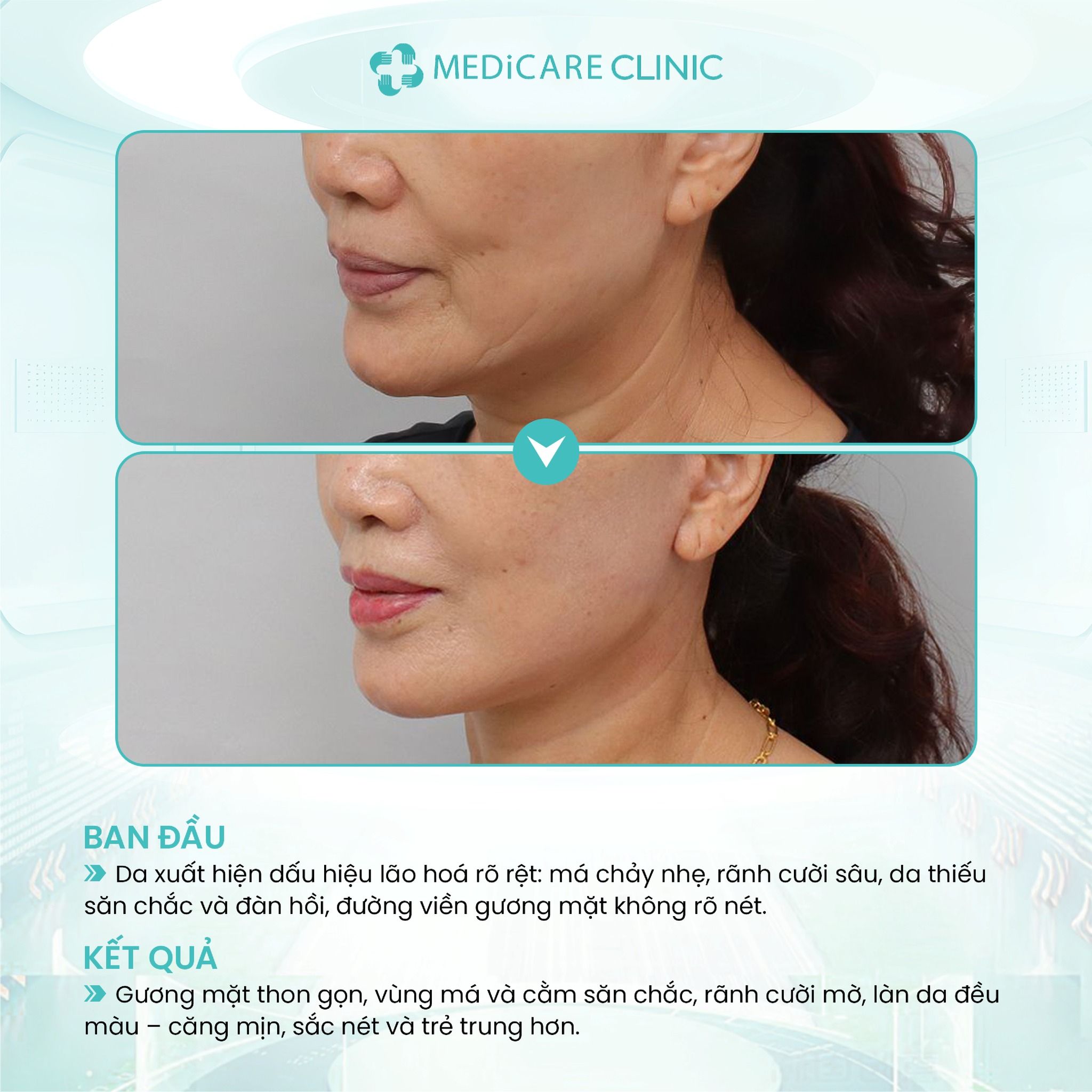 519093376_122179152860372117_3650565736688231757_n