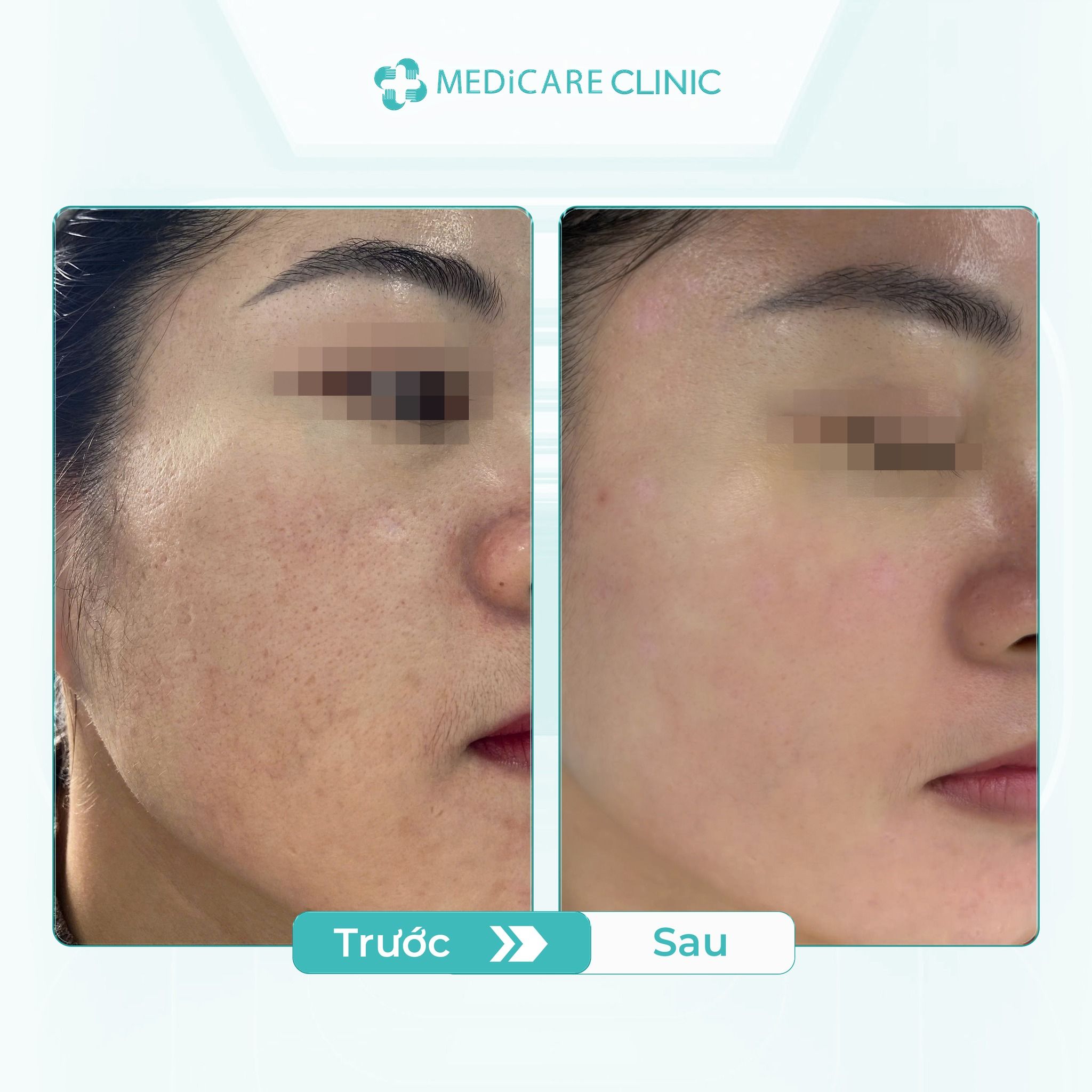 565809860_122191274162372117_4460889789031005632_n