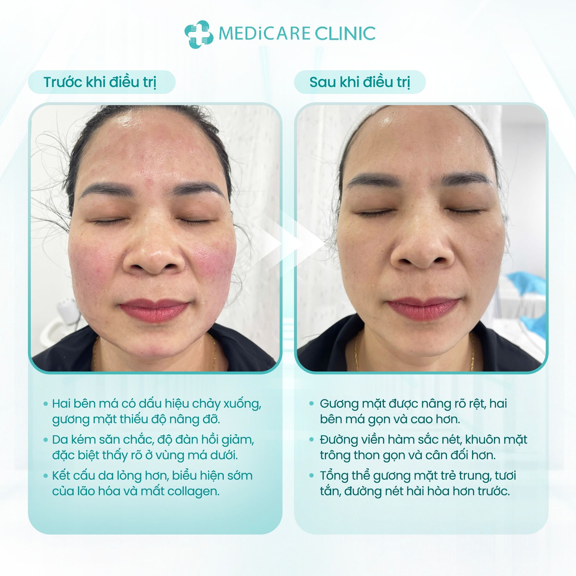 599498892_122198010206372117_3964382922308888405_n